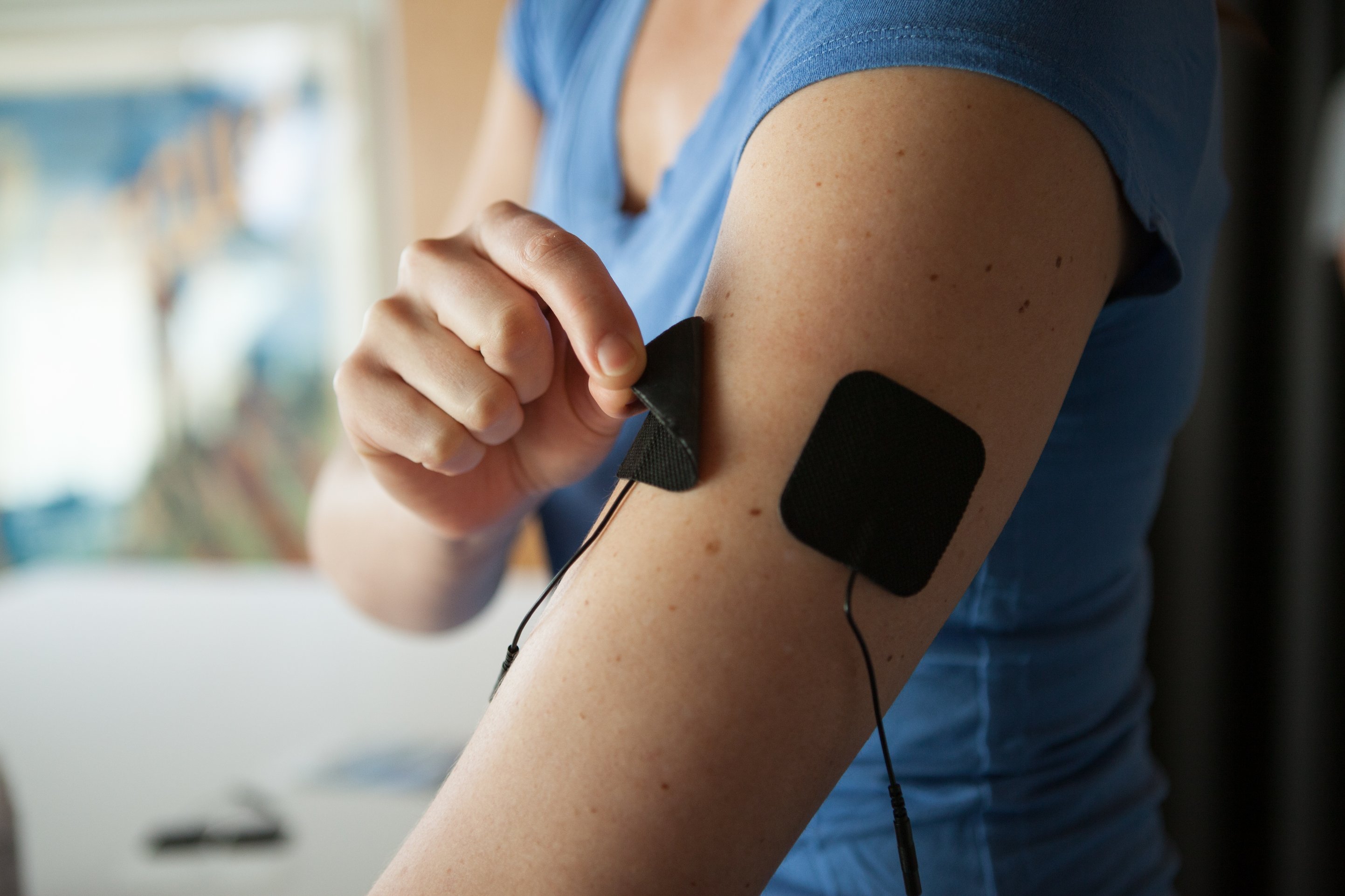 TENS Unit Electrode Pad Placement on Shoulder