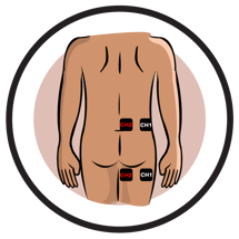How to Use a TENS Unit for Sciatica