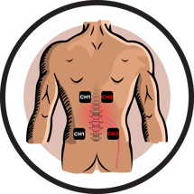 How to Use a TENS Unit for Sciatica